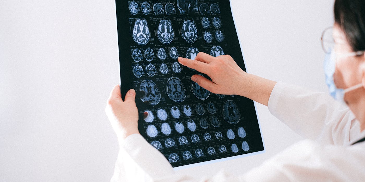 When Should You See a Neurosurgeon? 10 Clear Signs